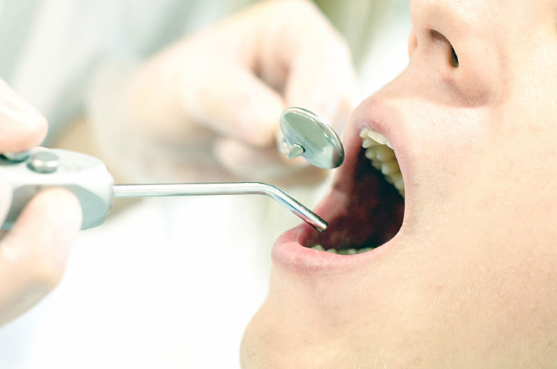 むし歯や歯周病などの口腔内の治療